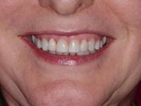 Irene Grafman DDS - Smile Health Spa image 2